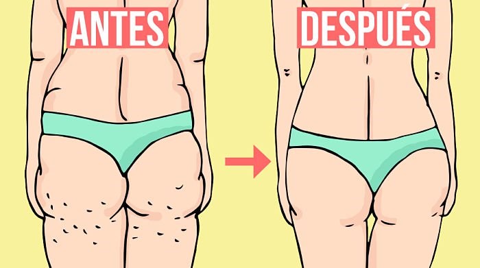 mitos-y-verdades-sobre-la-celulitis